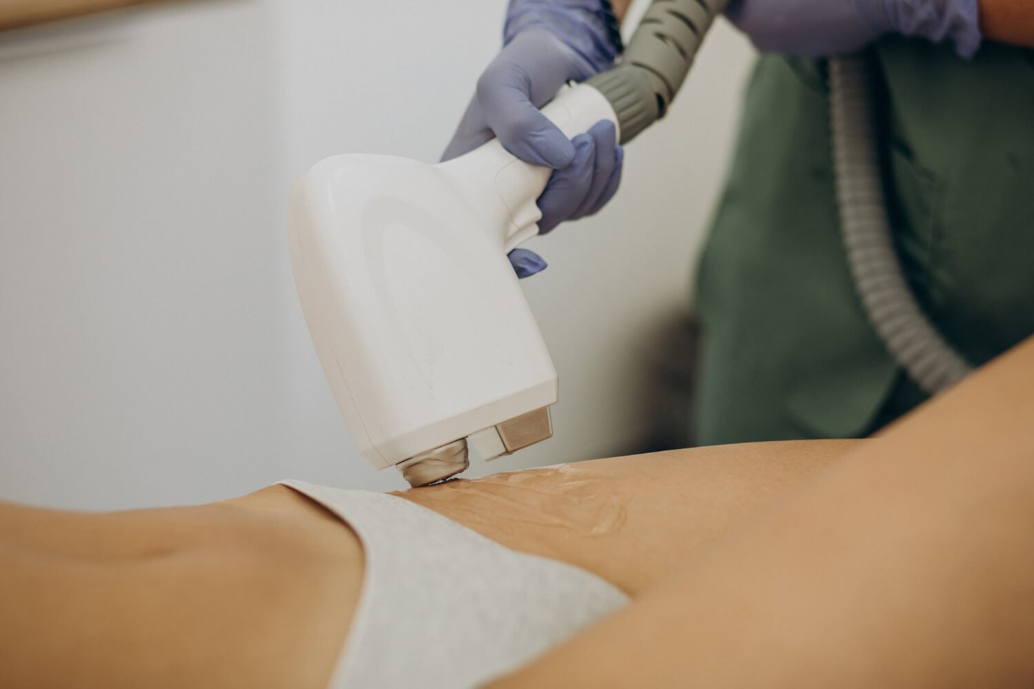 Depilação a laser feminino make vantagens
